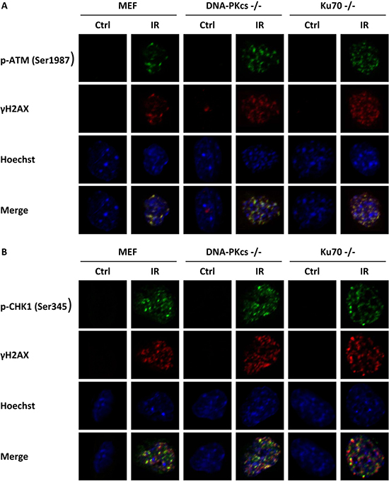 &#x03B3;H2AX is associated with phosphorylation of ATM and CHK1.