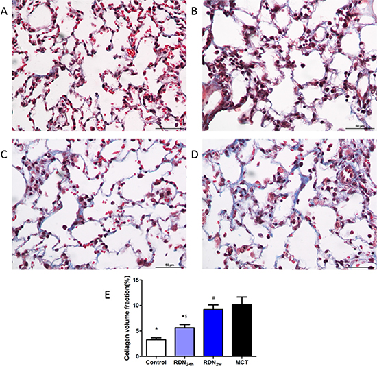 Effects of RDN on MCT-induced lung fibrosis histological section of lung.