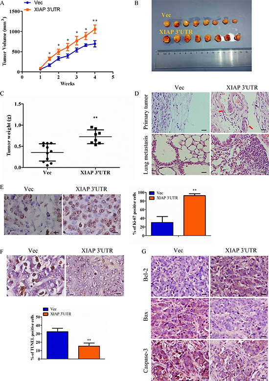 Expression of XIAP 3&#x2032;UTR enhances tumor growth and metastasis in vivo.