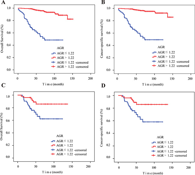Kaplan&#x2013;Meier curves for overall survival and cancer-specific survival according to preoperative AGR before and after PSM.