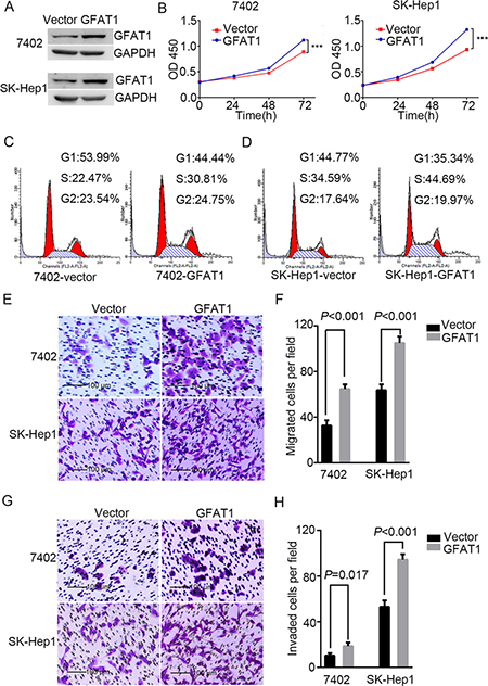Overexpression of GFAT1 promotes the tumorigenicity of HCC cells in vitro.