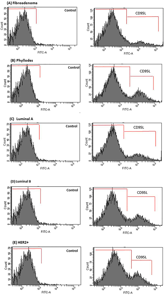 CD95L secretion is enhanced in CM of co-cultured breast tumor cells under PRP supplementation-HUVEC.