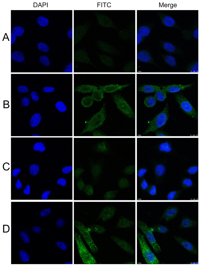Representative immunofluorescence staining pattern of anti-GRP78 antibody positive HCC serum samples.