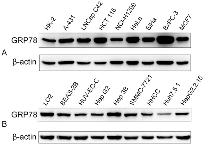 The expression of GRP78 in different cancer cell lines and the reaction of GRP78 with different serum samples.