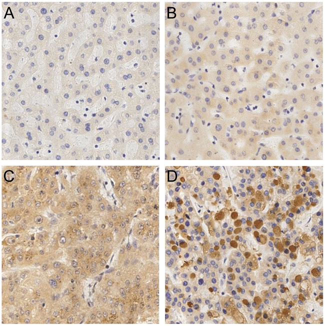 The expression of GRP78 in different liver tissues by immunohistochemistry.