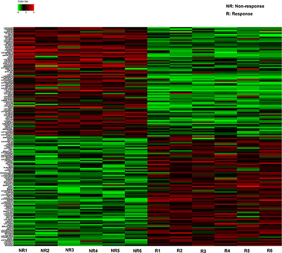 The heat map shows expression of the 160 lncRNAs most up- or down-regulated in GBM responding compared with non-responding patients to TMZ treatment.