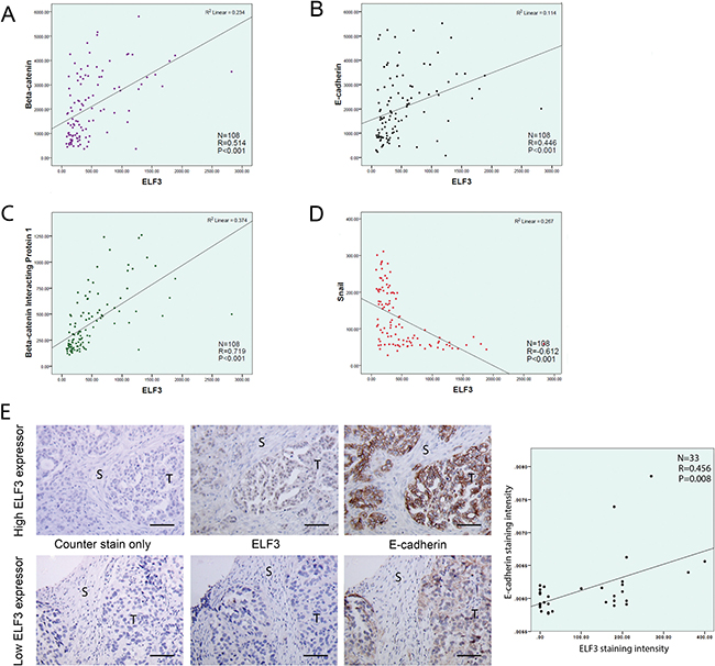 ELF3 expression is associated with epithelial phenotypes of ovarian cancer cells.