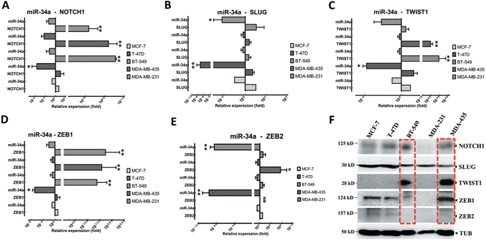 EMT-TFs demonstrate high expression levels in MBC cell lines in front of miR-34a expression.