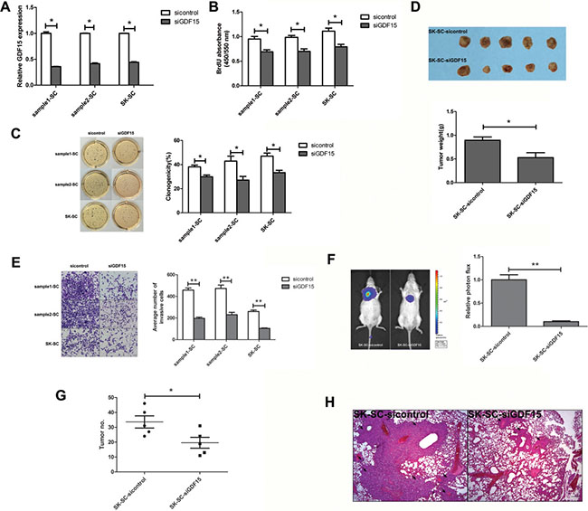 GDF15 knockdown inhibits the growth and metastasis of SCs in vitro and in vivo.