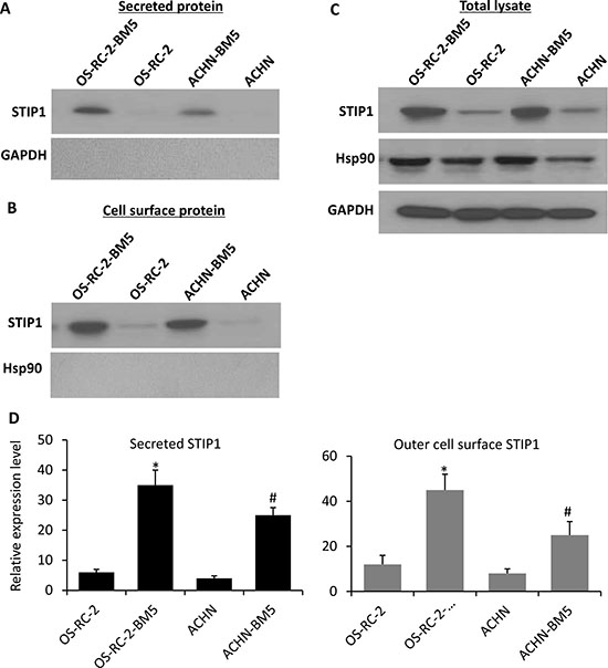 STIP1 in RCC tumor cells transported to cell membrane for secretion into culture medium.