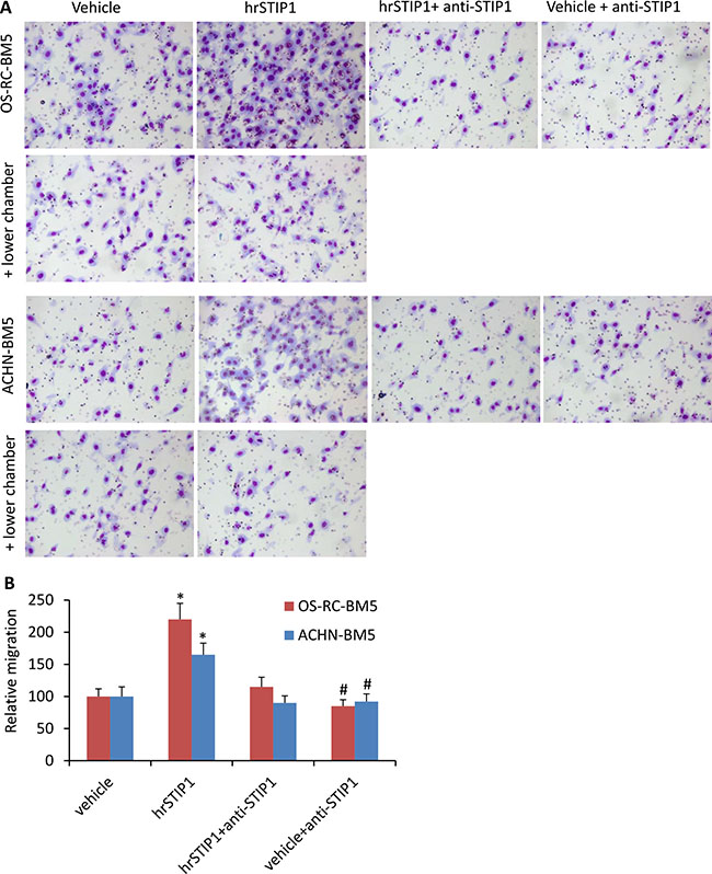 STIP1 promotes tumor cell migration/invasion.