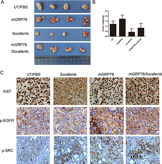 Secreted GRP78 promoted the proliferation of HCC cells and inhibited the sensitivity of HCC cells to sorafenib in vivo.