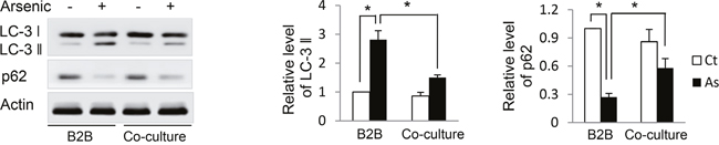 Co-culture with THP-1 M2 macrophages inhibits autophagy activity in B2B cells.