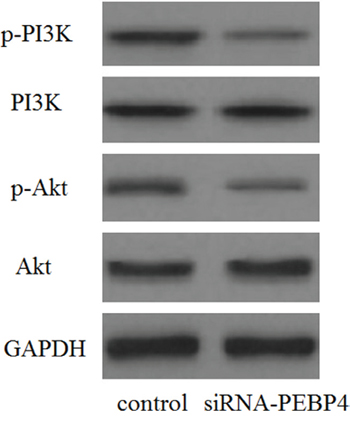 Knockdown of PEBP4 inhibited the activation of the PI3K/Akt signaling pathway.