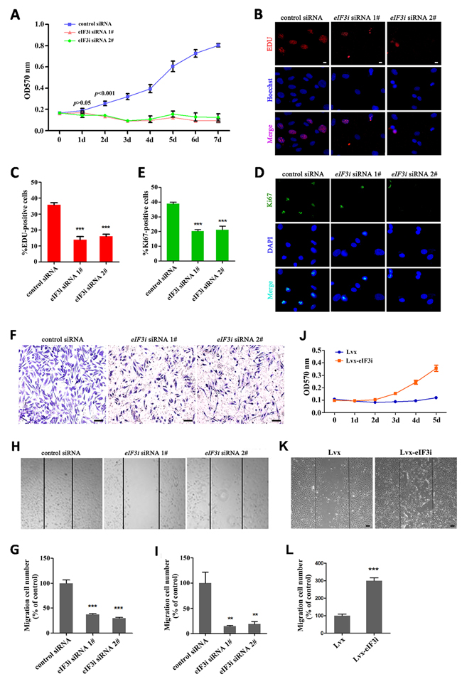 eIF3i promotes vascular endothelial cells proliferation and migration.