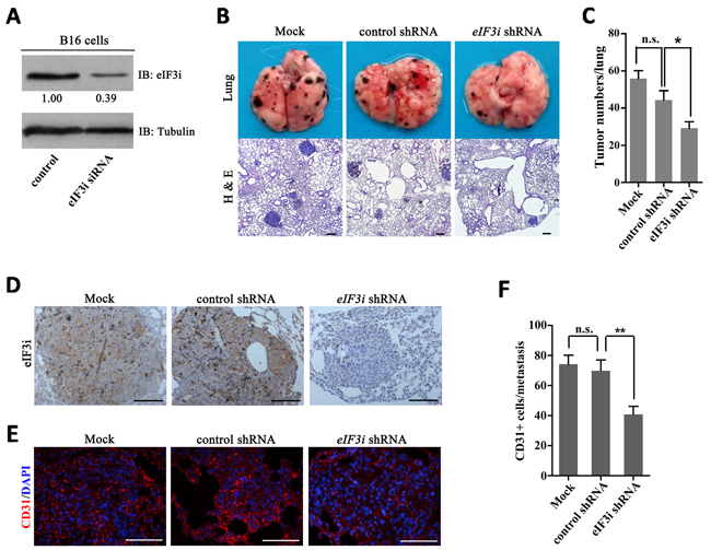 Inhibition of eIF3i reduced mouse melanoma metastasis.