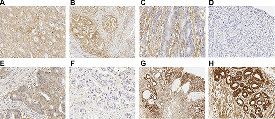 Immunohistochemical staining patterns of MCTs and MTCO1.