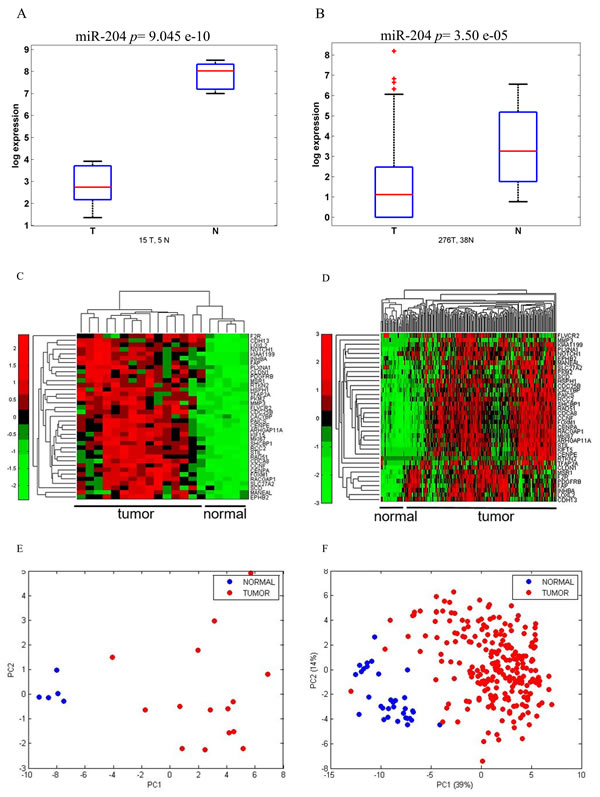 miR 204 and its target gene signature can discriminate between normal and tumoral gastric tissues.