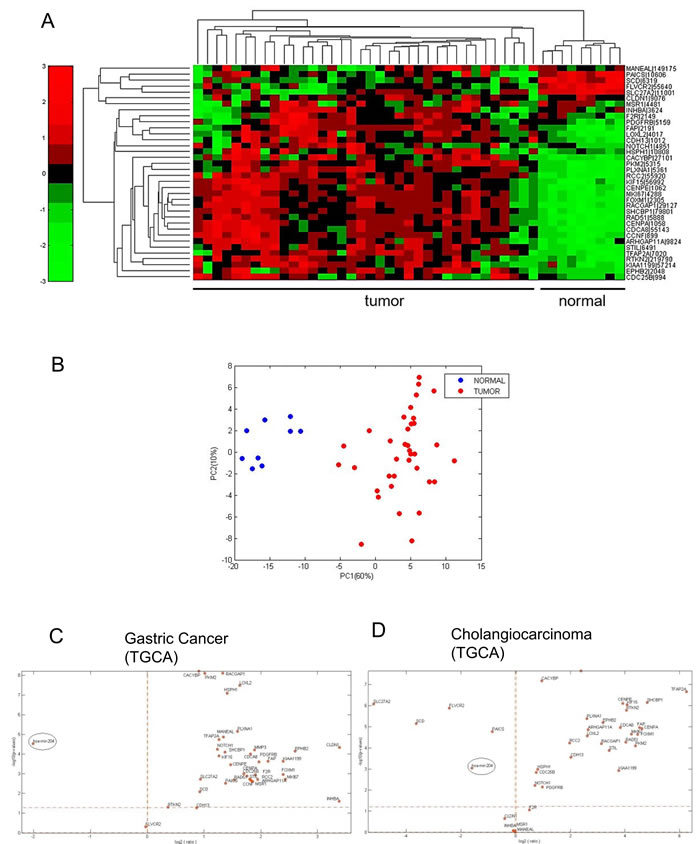 The miR-204 target gene signature is enriched in cholangiocarcinoma tissues