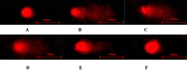 Typical DNA comet images of Leydig cells treated with DHEA and H