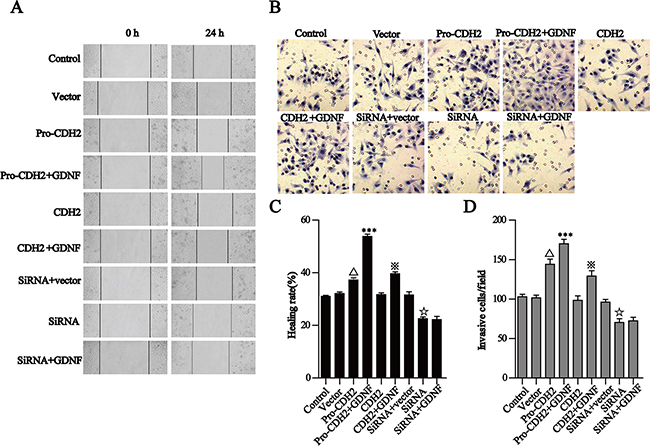 GDNF promotes U251 cell migration and invasion via proN-cadherin in vitro.