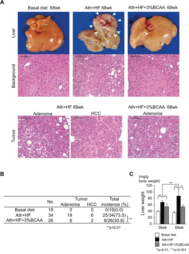 Effects of BCAA supplementation on liver tumorigenesis in C57BL/6J mice fed the Ath+HF diet.