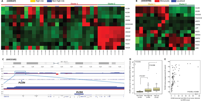 Transcriptomic and genomic reappraisals identify PLCB4 as the top-ranking lipid catabolism-regulating gene associated with aggressive GISTs.