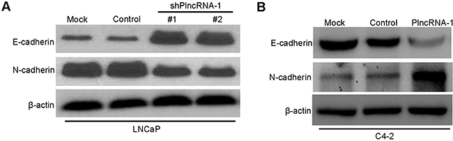 Effect of PlncRNA-1 on EMT in LNCaP and C4-2 cells after silencing and overexpression of PlncRNA-1.
