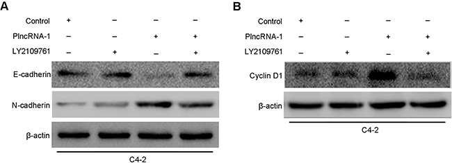 Effects of PlncRNA-1 overexpression and TGF-&#x03B2;1 inhibitor LY2109761 addition on EMT and CyclinD1 in C4-2 cells.