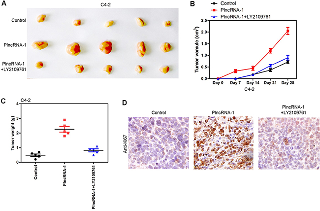 Tumor growth in nude mice following overexpression of PlncRNA-1 and the addition of TGF-&#x03B2;1 inhibitor LY2109761 in C4-2 cells.