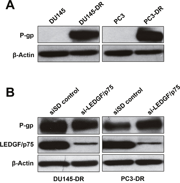 LEDGF/p75 depletion in DTX-resistant cells does not lead to downregulation of P-glycoprotein.