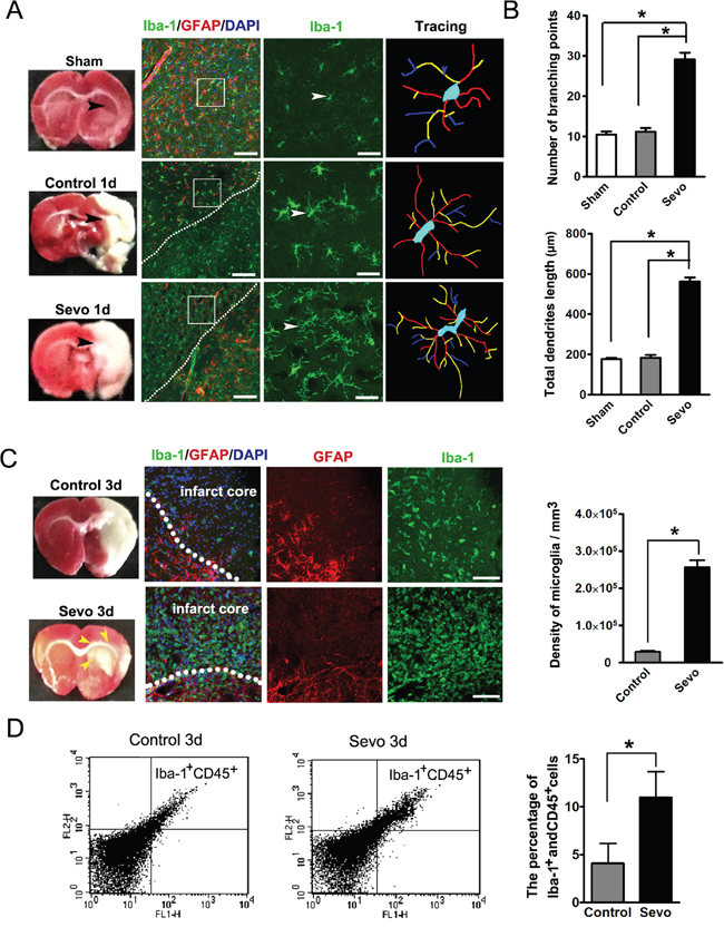 Sevoflurane preconditioning accelerated microglia activated.