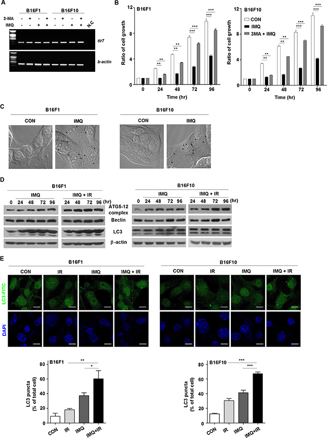 IMQ combined with IR enhance the autophagic death of melanoma cells.