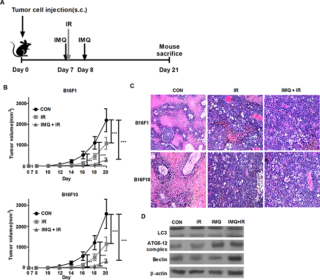 IMQ radiosensitizes melanoma in an in vivo mouse model.