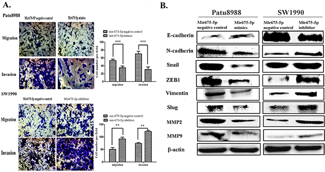 Mir-675-5p has an effect on cell migration and invasion of pancreatic cancer in vitro.