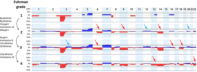 Chromosomal imbalances associated with grading of ccRCC tumors.