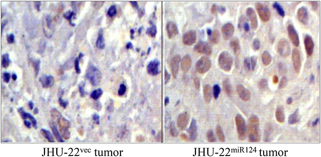 TUNEL assay showing a significantly higher number of apoptotic cells in JHU-22miR124 than in JHU-22vec tumor xenografts.