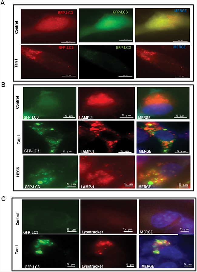 Tan I promotes autolysosome formation through colocalization of GFP-LC3 with LAMP-1 or LysoTracker in H28 cells.