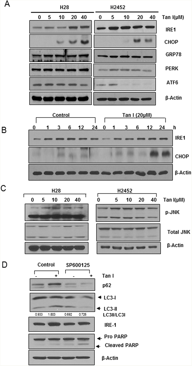 Tan I upregulates IRE1, CHOP and p-JNK in H28 cells.