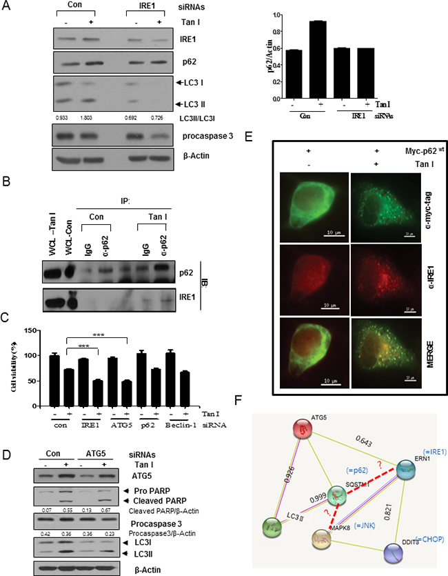 IRE1 and JNK signaling pathways are critically involved in Tan I-induced autophagy in H28 cells.