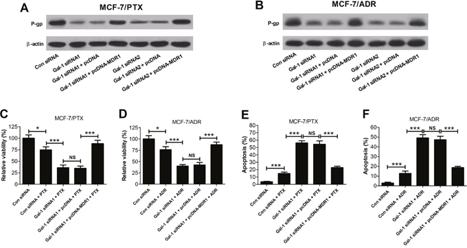 Effects of MDR1 overexpression on the sensitivity to PTX and ADR induced by Gal-1 knockdown in MCF-7/PTX and MCF-7/ADR cells.