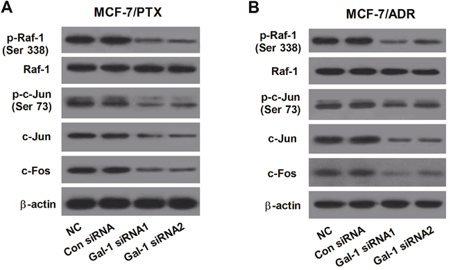 Gal-1 knockdown significantly suppressed the Raf-1/AP-1 signaling pathway.