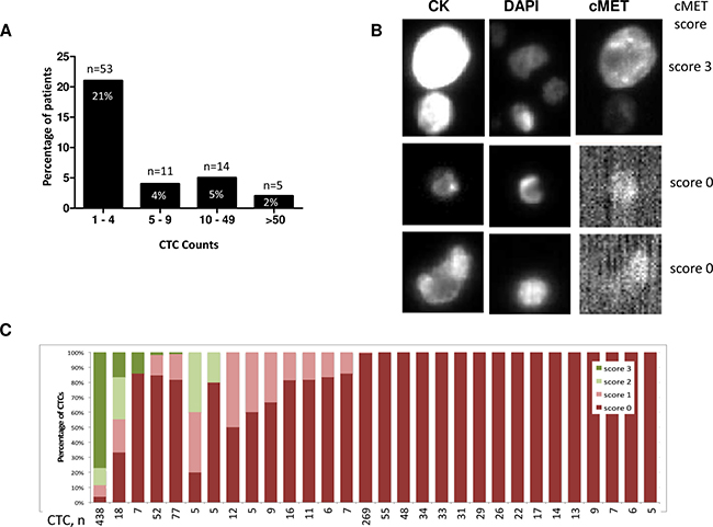 CTC enumeration and MET protein staining in blood samples evaluated on the CellSearch system.