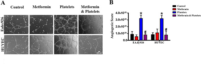 Metformin abrogates the platelet-increased formation of capillary-like structures in matrigel (angiogenesis).