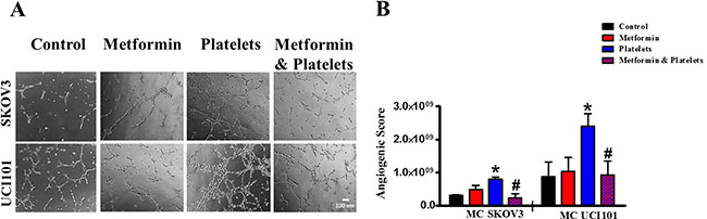 Platelets increase the pro-angiogenic balance of factors liberated from ovarian cancer cell lines, an effect inhibited by metformin.
