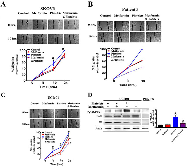 Metformin inhibits cancer cell migration induced by platelets.