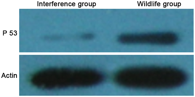 P53 protein levels detected by western blot.