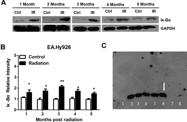 Radiation activates the NF-&#x03BA;B pathway in EA.Hy926 cells.