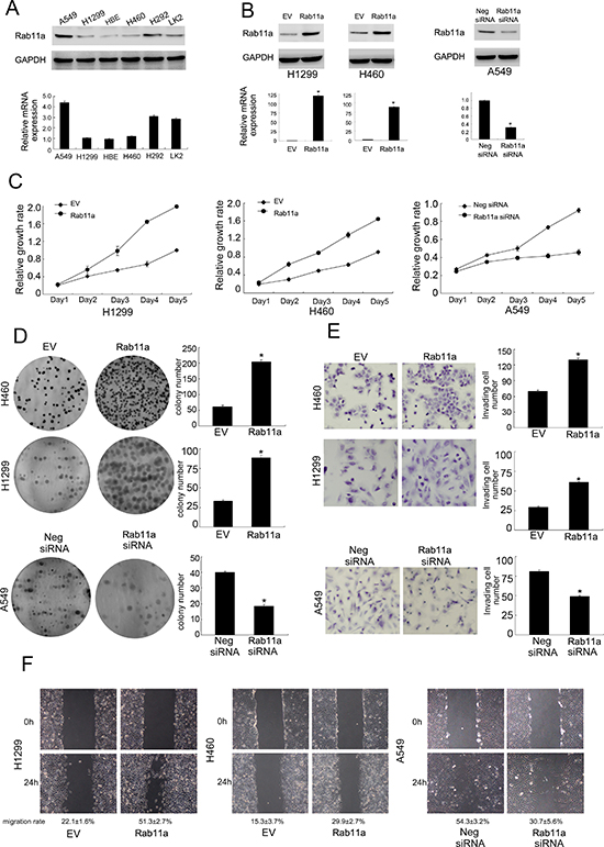 Rab11a expression in lung cancer cell lines and its role on proliferation, invasion and migration.