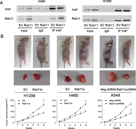 Rab11a interacts with YAP and promotes lung cancer cell growth in vivo.